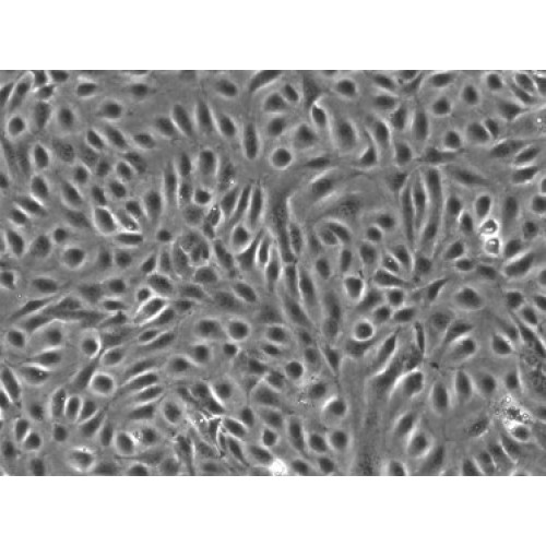 Human Primary Diabetic Artery Endothelial Cells