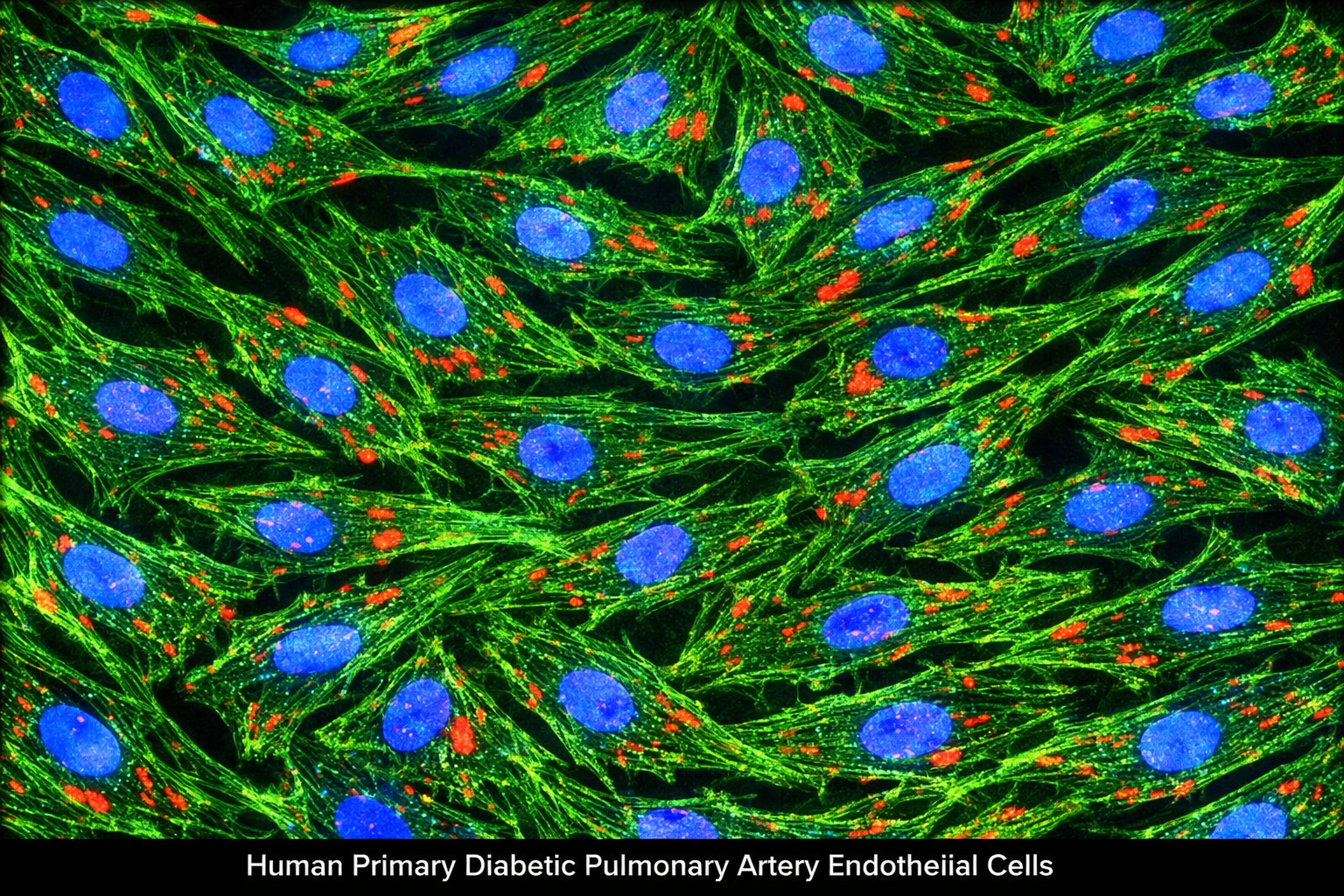 Human Primary Diabetic Pulmonary Artery Endothelial Cells