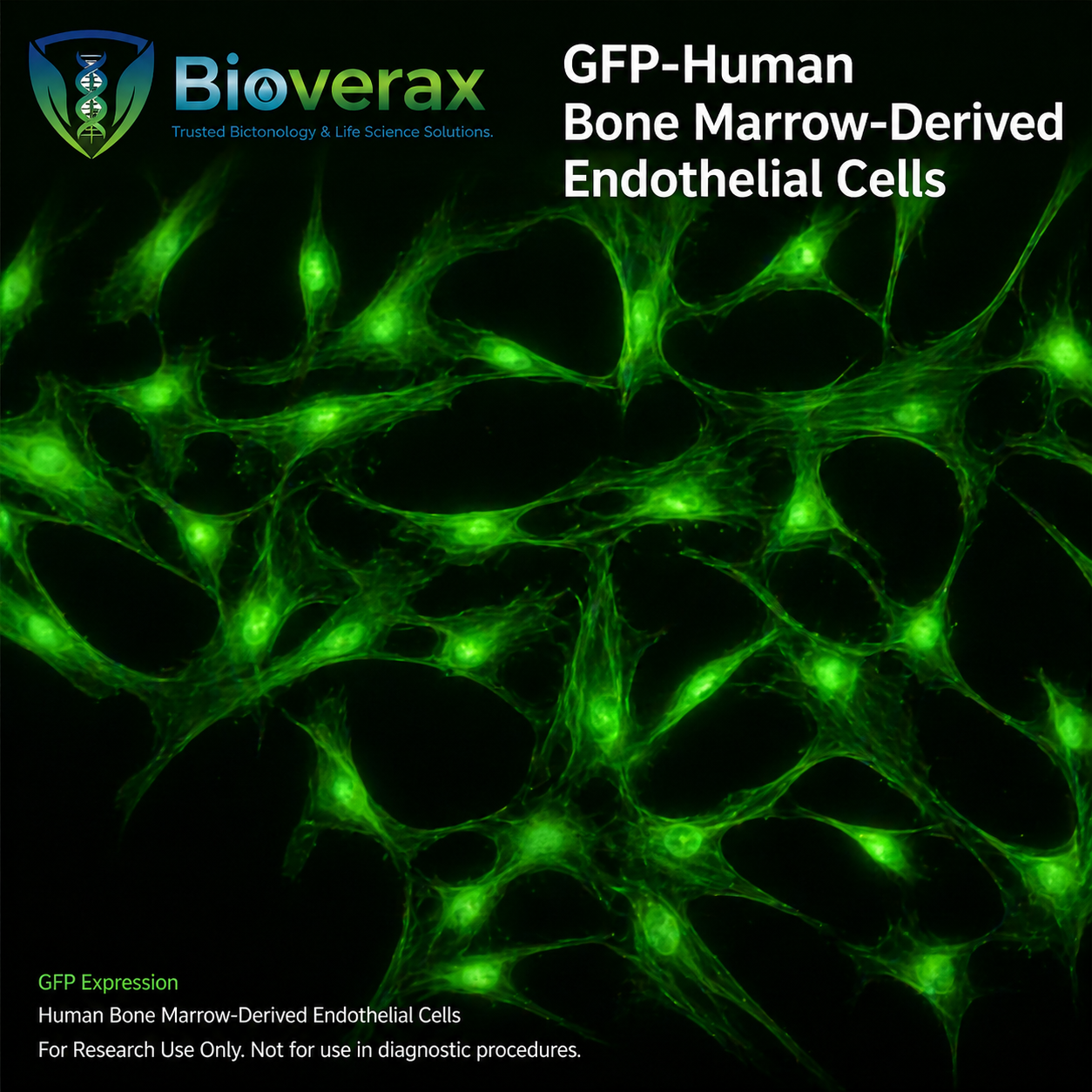 GFP-Human Bone Marrow-Derived Endothelial Cells
